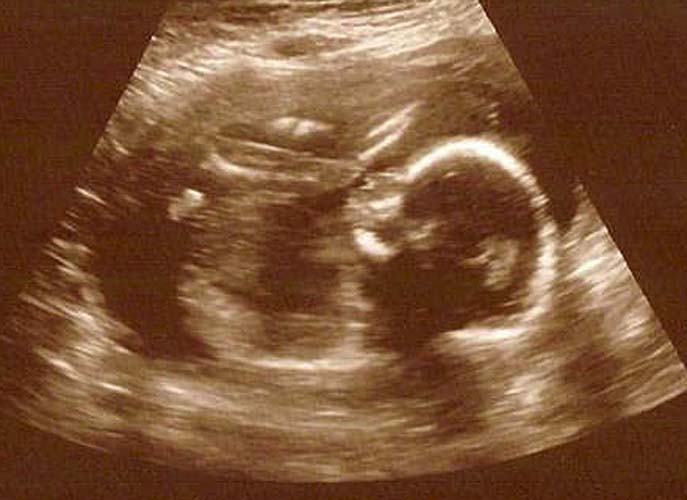 Another Grandchild